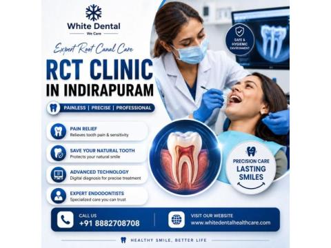 RCT Clinic in Indirapuram for Painless Root Canal Treatment