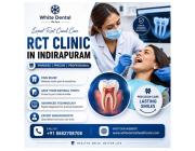 RCT Clinic in Indirapuram for Painless Root Canal Treatment
