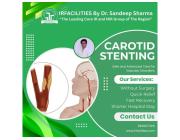 Carotid Stenting | Minimally Invasive Treatment for Stroke Prevention