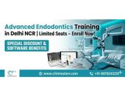 💡 Become Confident in Modern Root Canal Procedures