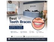 Best Teeth Braces in Kathmandu Nepal for Smiles