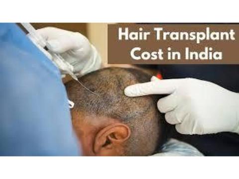Best Hair Transplant Clinic in Delhi | MedLinks Hair Transplant