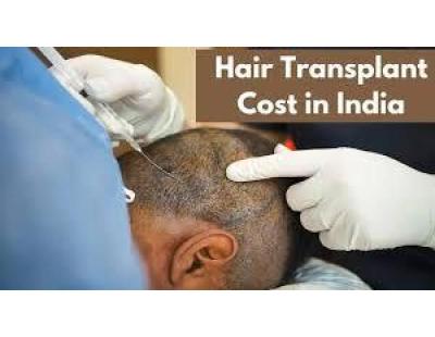 Best Hair Transplant Clinic in Delhi | MedLinks Hair Transplant