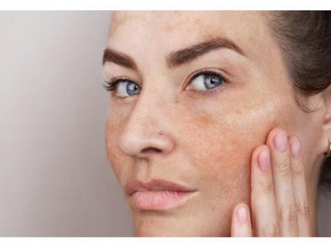 Best Skin Specialist in Gurgaon | Advanced Skin Care | Estique Clinic