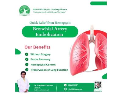 Explanations of BAE Medical Abbreviation – Bronchial Artery Embolization