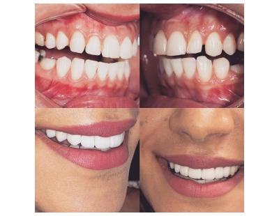 Cosmetic Dentistry in Richmond, TX | Transform Your Smile at Charm Dental - Richmond
