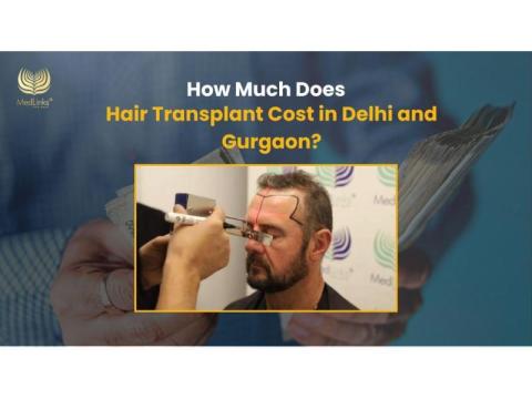 Get Affordable Hair Transplant in Delhi by MedLinks