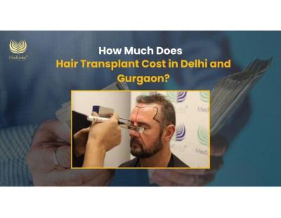 Get Affordable Hair Transplant in Delhi by MedLinks