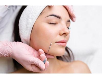 Best Thread Lifting Treatment in Amritsar | Cosmetique by Simrat Sandhu