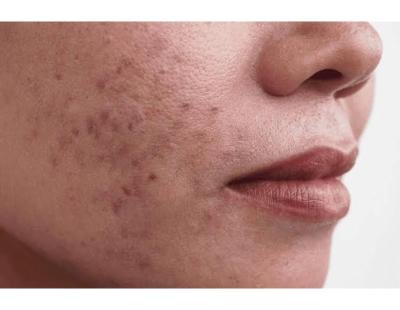 Luxe Face and Body Med Spa
