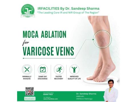 Varicose Veins Specialist | Effective Minimally Invasive Varicose Vein Treatment | IRFacilities