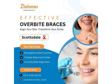 Effective Overbite Braces in Scottsdale