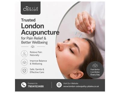 Trusted London Acupuncture for Pain Relief & Better Wellbeing