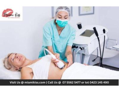 Advanced Fat Freezing Treatment Gold Coast
