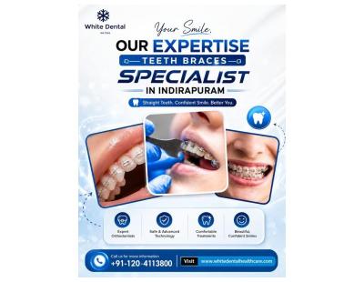 Teeth Braces Specialist in Indirapuram for Perfect Smile Alignment