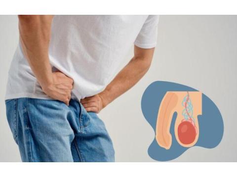 Varicocele Doctor | Expert Minimally Invasive Varicocele Treatment