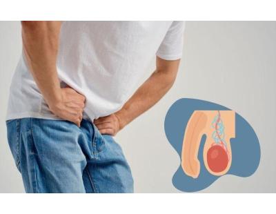 Varicocele Doctor | Expert Minimally Invasive Varicocele Treatment