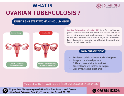 Expert Ovarian TB Care by the Best Gynecologist in Gaur City