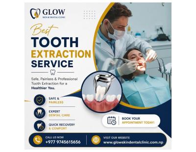 Best Tooth Extraction Service with Expert Dental Care