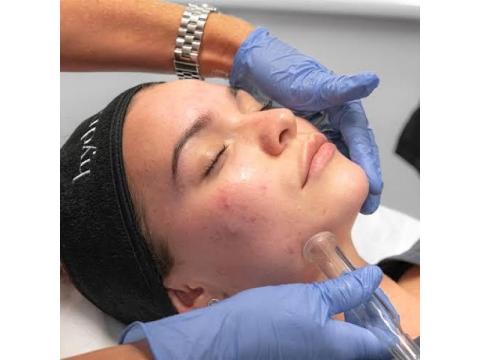 Hydra Facial in Brisbane for Radiant, Healthy Skin