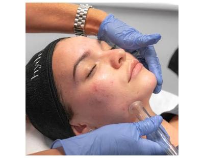 Hydra Facial in Brisbane for Radiant, Healthy Skin
