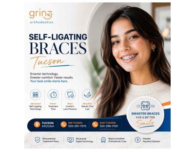 Self-Ligating Braces Tucson