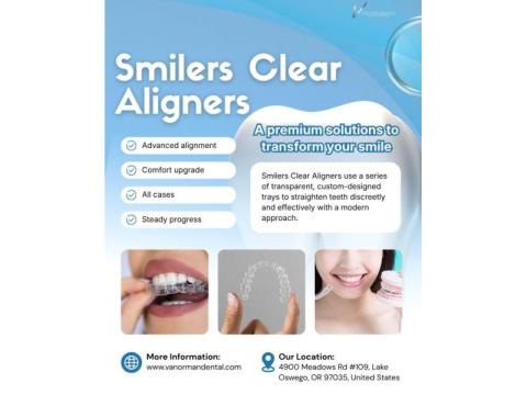 How Long Do Smilers Clear Aligners Take to Straighten Teeth?