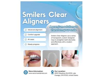 How Long Do Smilers Clear Aligners Take to Straighten Teeth?
