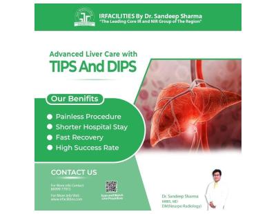 Transjugular Intrahepatic Portosystemic Shunt | Advanced TIPS Procedure