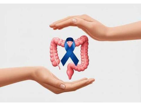 Colon Cancer Treatment in Noida | Dr. Manish Singhal Care