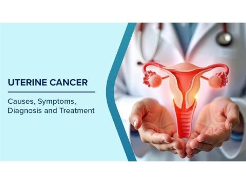 Leading Uterine Cancer Treatment in Noida | Dr. Manish Singhal
