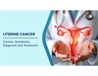 Leading Uterine Cancer Treatment in Noida | Dr. Manish Singhal