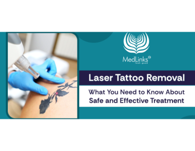 Laser Tattoo Removal in Gurgaon | MedLinks