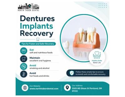 How Painful Are Denture Implants?