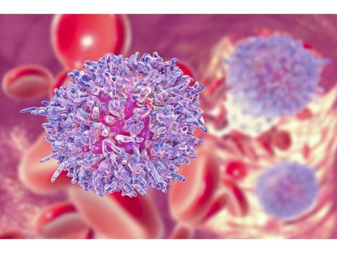 Expert Leukemia Cancer Treatment in Noida | Dr. Manish Singhal