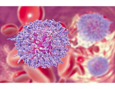 Expert Leukemia Cancer Treatment in Noida | Dr. Manish Singhal