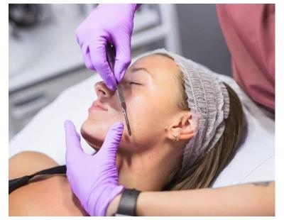Dermaplaning Spring Hill FL