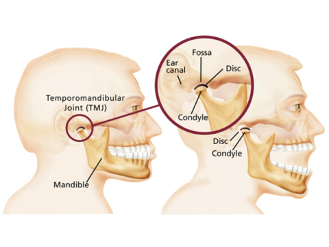 TMJ Treatment Melbourne for Jaw Pain Relief