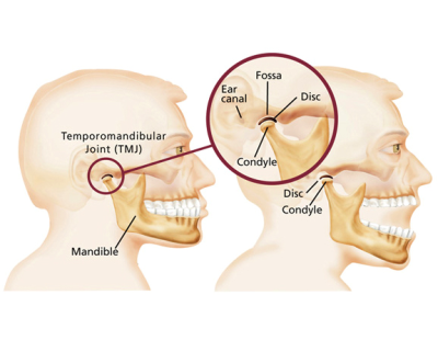 TMJ Treatment Melbourne for Jaw Pain Relief