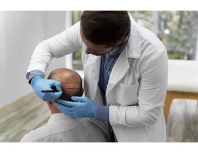 Compassionate Hair Loss Treatment for Cancer Survivors | Hair Clinique Restoration Center