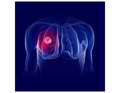 Advanced Targeted Therapy Treatment in Noida | Dr. Manish Singhal