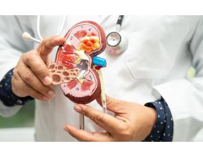 Best Kidney Specialist in Dwarka for Expert Kidney Care | Ayushman Hospital