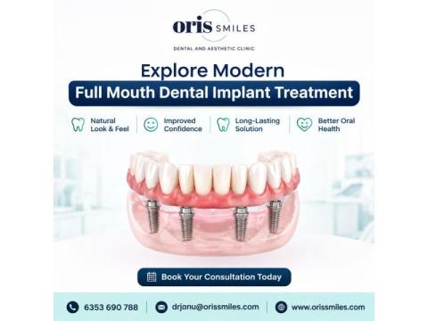Explore Modern Full Mouth Dental Implant Treatment
