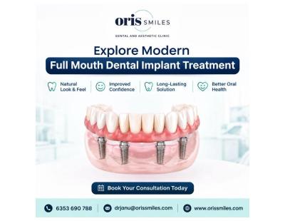 Explore Modern Full Mouth Dental Implant Treatment