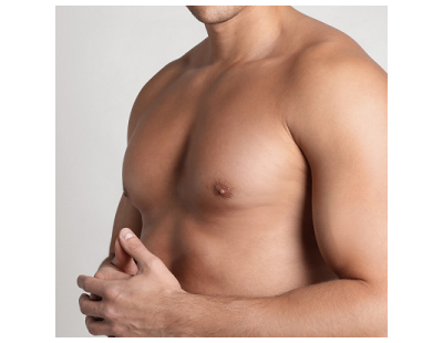 Gynecomastia Surgery: Common Myths You Should Stop Believing
