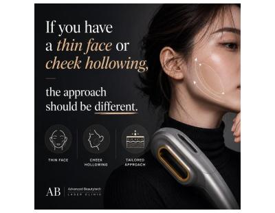 Fractional RF Balwyn | RF Skin Resurfacing | Advanced Beautytech Laser Clinic