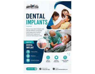 How Dental Implants Procedure Work?
