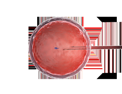 Choose the Right ICSI Treatment Centre in Delhi | Queens IVF