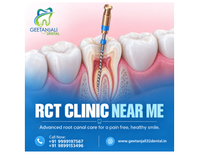 RCT Clinic Near You for Comfortable Root Canal Treatment