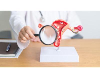 Fibroids and IVF in Delhi | Advanced Fertility Care – Fertylity IVF